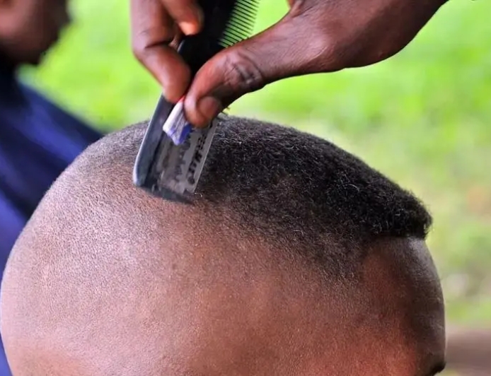 Indwara ziterwa no kogosha umusatsi